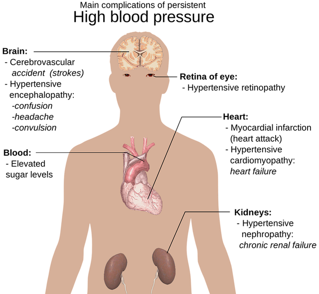 anatomy image showing complications of persistent high blood pressure